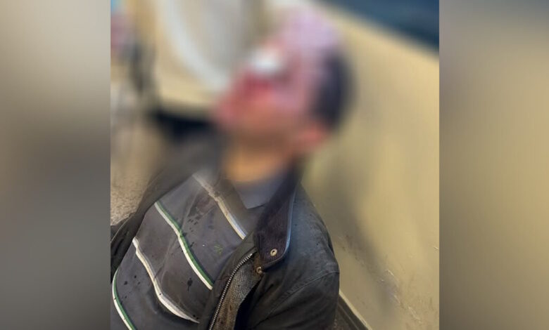 Νομική:-Στο-μικροσκόπιο-οι-κάμερες-ασφαλείας-για-τον-εντοπισμό-των-8-κουλουφόρων-που-χτύπησαν-φοιτητή-–-Τι-ερευνά-η-ΕΛ.ΑΣ