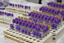 Τι-παθαίνει-ο-ανθρώπινος-οργανισμός-όταν-γίνεται-λανθασμένη-μετάγγιση-αίματος-όπως-συνέβη-στο-Τζάνειο-με-την-62χρονη