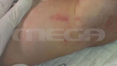 Πάτρα:-«”Έφυγε”-από-παθολογικά-αίτια»,-επιμένει-η-μητέρα-του-2,5-μηνών-βρέφους-που-πέθανε-το-2013-–-«Η-γυναίκα-μου-χαστούκισε-την-κόρη-μας»,-λέει-ο-πατέρας