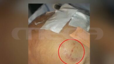 Όλο-το-πόρισμα-Γκότση-για-το-2,5-μηνών-βρέφος-που-κατέληξε-στην-Πάτρα-–-Οι-μαρτυρίες-και-τα-σημάδια-που-αγνοήθηκαν