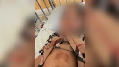 Χαλκιδική:-Βίντεο-με-τον-λύκο-που-επιτέθηκε-και-τραυμάτισε-ένα-5χρονο-κοριτσάκι