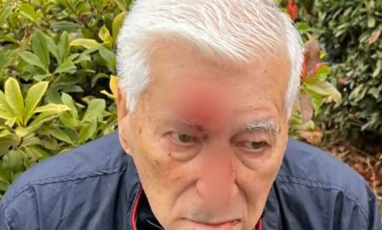 Θεσσαλονίκη:-82χρονος-δέχτηκε-επίθεση-από-γιατρό-«μποξέρ»-–-«Μου-είπε-ότι-του-χτύπησα-το-αμάξι-και-μου-έδωσε-2-μπουνιές»