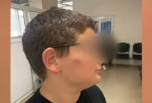 Θεσσαλονίκη:-ΕΔΕ-για-τον-ξυλοδαρμό-11χρονου-μαθητή-από-άλλους-μαθητές-σε-δημοτικό-σχολείο-στο-Παλαιόκαστρο