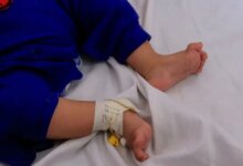 Λάρισα:-Έπαθε-ανακοπή-το-μωρό-με-τα-εγκαύματα-από-το-καυτό-λάδι-–-Νοσηλεύεται-σε-κρίσιμη-κατάσταση-αφού-το-επανέφεραν-οι-γιατροί