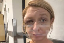 Κορωπί:-«Είναι-σε-τραγική-κατάσταση»-λέει-η-μητέρα-της-40χρονης-μετά-τον-άγριο-ξυλοδαρμό-–-«Θα-την-πάρω-πίσω-στη-Λιθουανία»