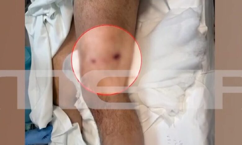 Βορίζια:-Νέες-φωτογραφίες-από-το-μακελειό-–-Άφαντα-παραμένουν-τα-όπλα-της-αιματοχυσίας