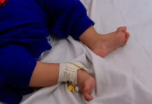 Βρετανία:-Μωρό-13-μηνών-υπέστη-καρδιακή-προσβολή-και-έχασε-τη-μισή-του-γλώσσα-αφού-μπέρδεψε-αποφρακτικό-υγρό-με-γάλα