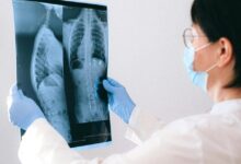 Δύο-Έλληνες-δημιουργοί-πρωτοποριακής-τεχνικής-για-την-αντιμετώπιση-παιδικών-όγκων