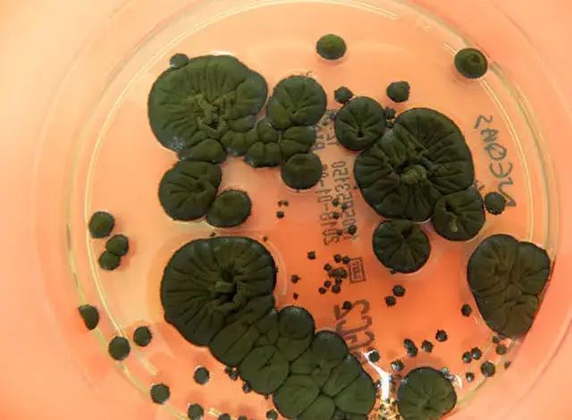 Βρήκαν-στο-Τσερνόμπιλ-μύκητα-που-μετατρέπει-τη-ραδιενέργεια-σε-χημική-ενέργεια