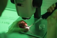 Επτά-κλινικές-στην-Ελλάδα-έλαβαν-το-σπέρμα-του-Δανού-δότη-με-το-γονίδιο-καρκίνου-–-Εντοπίστηκαν-4-περιπτώσεις-φορέων