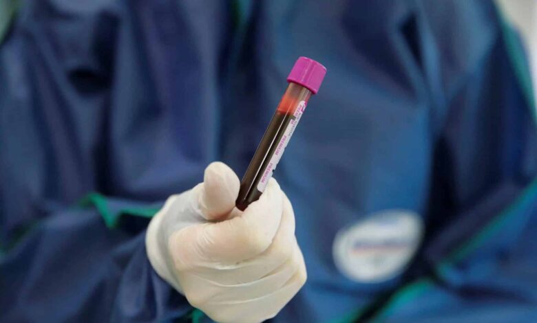 Πώς-αποκαλύφθηκε-η-υπόθεση-του-Δανού-δότη-σπέρματος-με-καρκινικό-γονίδιο-και-γιατί-δεν-ανιχνεύθηκε