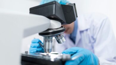 Πέτρες-στα-νεφρά:-Γιατί-μεγαλώνει-ο-κίνδυνος-στις-γιορτές-και-πώς-να-τον-προλάβετε