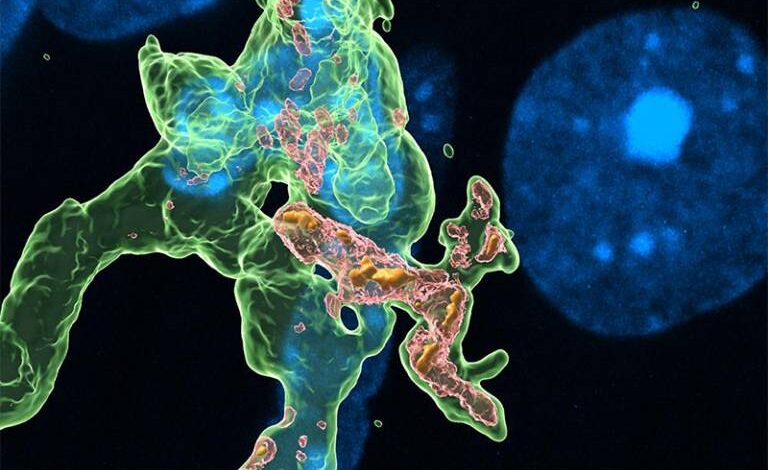 Πάρκινσον:-Νέα-έρευνα-για-το-πώς-η-νόσος-εξαπλώνεται-από-το-έντερο-στον-εγκέφαλο