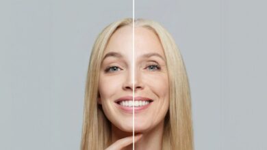 Αντιγήρανση:-Τροφές-και-βιταμίνες-που-προστατεύουν-το-δέρμα