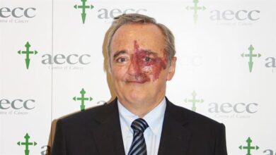 Μαριάνο-Μπαρμπασίντ:-Ο-Ισπανός-βιοχημικός-που-βρήκε-τρόπο-θεραπείας-του-καρκίνου-παγκρέατος