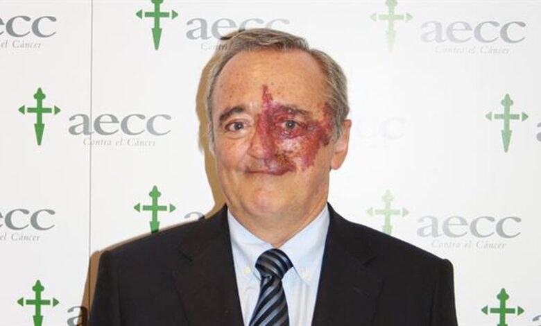 Μαριάνο-Μπαρμπασίντ:-Ο-Ισπανός-βιοχημικός-που-βρήκε-τρόπο-θεραπείας-του-καρκίνου-παγκρέατος