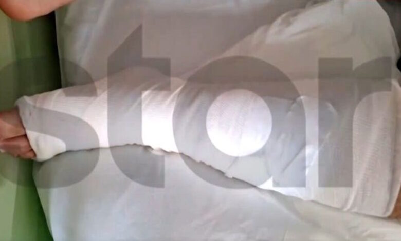 Αίγιο:-Σοκάρουν-τα-τραύματα-από-τα-σκάγια-που-δέχθηκε-15χρονος-όταν-46χρονος-πυροβόλησε-πισώπλατα-ανηλίκους