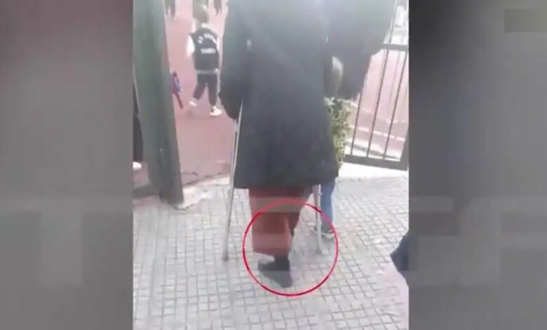 Ζωγράφου:-Νηπιαγωγός-πήγε-στο-σχολείο-με-γύψο-και-πατερίτσα-–-«Αναγκάστηκα-για-να-μη-χάσω-τη-θέση-μου»