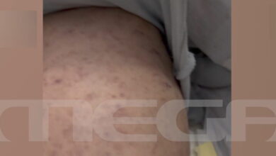 Σε-αναστολή-η-παιδίατρος-για-την-υπόθεση-του-βρέφους-που-νοσηλεύεται-με-μηνιγγίτιδα-σε-ΜΕΘ-στην-Πάτρα