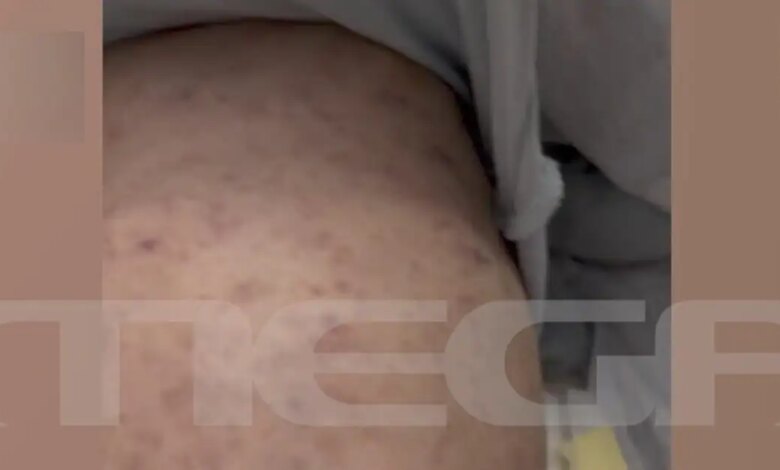 Σε-αναστολή-η-παιδίατρος-για-την-υπόθεση-του-βρέφους-που-νοσηλεύεται-με-μηνιγγίτιδα-σε-ΜΕΘ-στην-Πάτρα