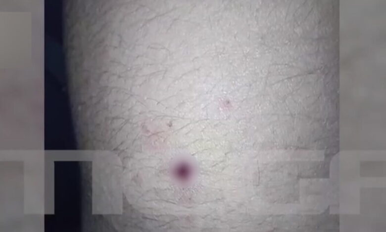 Αίγιο:-Νέες-φωτογραφίες-με-τα-τραύματα-των-παιδιών-–-«Ο-46χρονος-έκρυψε-την-καραμπίνα-και-πήγε-για-ύπνο»