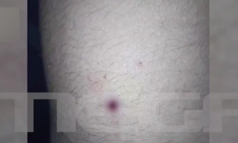 Αίγιο:-Νέες-φωτογραφίες-με-τα-τραύματα-των-παιδιών-–-«Ο-46χρονος-έκρυψε-την-καραμπίνα-και-πήγε-για-ύπνο»