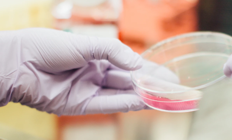 Ποιοι-βρίσκονται-σε-κίνδυνο-για-καρκίνο-του-παχέος-εντέρου;