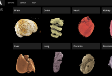 Εντυπωσιακός-τρισδιάστατος-Άτλας-Ανθρωπίνων-Οργάνων