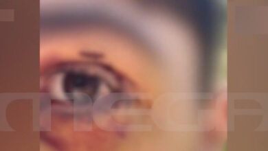 Ιωάννινα:-Άγριος-ξυλοδαρμός-16χρονου-από-ανήλικους-–-«Πήγε-βόλτα-και-κινδύνευσε-να-χάσει-την-όρασή-του»-λέει-η-μητέρα-του