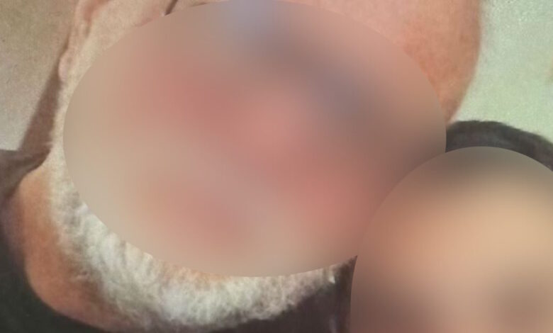 Βέροια:-«Το-παιδί-είναι-σε-πολύ-άσχημη-κατάσταση,-βρίσκεται-ακόμα-σε-κώμα»-λέει-ο-πατέρας-της-24χρονης-για-τον-ξυλοδαρμό-από-τον-20χρονο