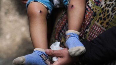 Ισραηλινοί-στρατιώτες-βασάνισαν-18μηνο-παιδάκι-στη-Γάζα