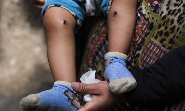 Ισραηλινοί-στρατιώτες-βασάνισαν-18μηνο-παιδάκι-στη-Γάζα