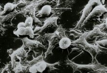 Ένα-απλό-τεστ-αίματος-θα-εντοπίζει-τον-καρκίνο-και-άλλες-παθήσεις