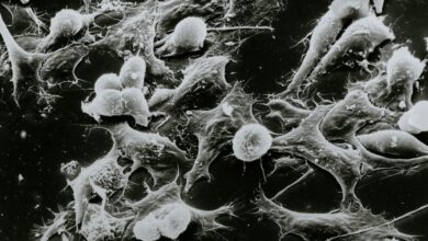 Ένα-απλό-τεστ-αίματος-θα-εντοπίζει-τον-καρκίνο-και-άλλες-παθήσεις