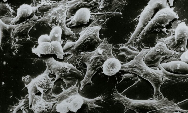 Ένα-απλό-τεστ-αίματος-θα-εντοπίζει-τον-καρκίνο-και-άλλες-παθήσεις