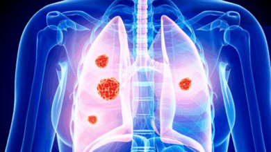 Άνοδος-καρκίνων-του-αίματος-μετά-από-θεραπεία-διαφορετικού-καρκίνου-–-Τι-αποκαλύπτει-νέα-μελέτη