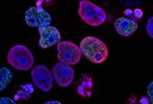 “Η-εξέλιξη-στην-καταπολέμηση-του-καρκίνου-την-τελευταία-δεκαετία”