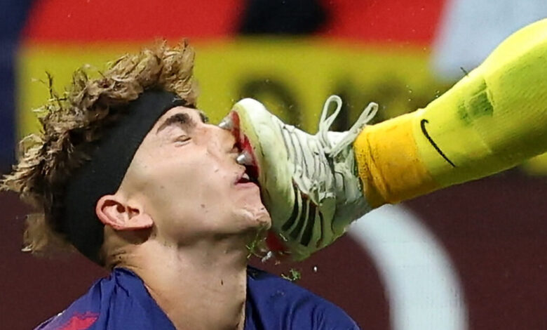Ο-Φερμίν-Λόπες-δέχθηκε-τις-τάπες-του-Μούσο-στο-πρόσωπο-και-του-άνοιξε-η-μύτη,-απίστευτος-τραυματισμός-στο-Ατλέτικο-–-Μπαρτσελόνα