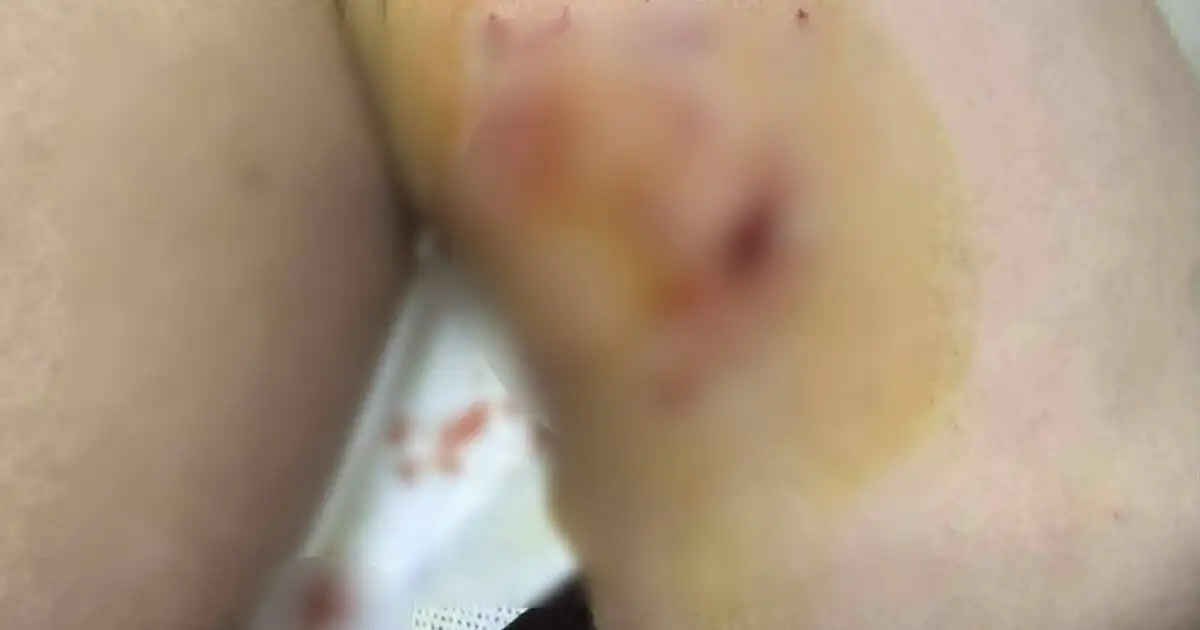 Κρήτη:-Άγρια-επίθεση-σκύλου-σε-12χρονο-στη-Μεσαρά-–-Τον-τραυμάτισε-σοβαρά-σε-πολλά-σημεία-του-σώματος