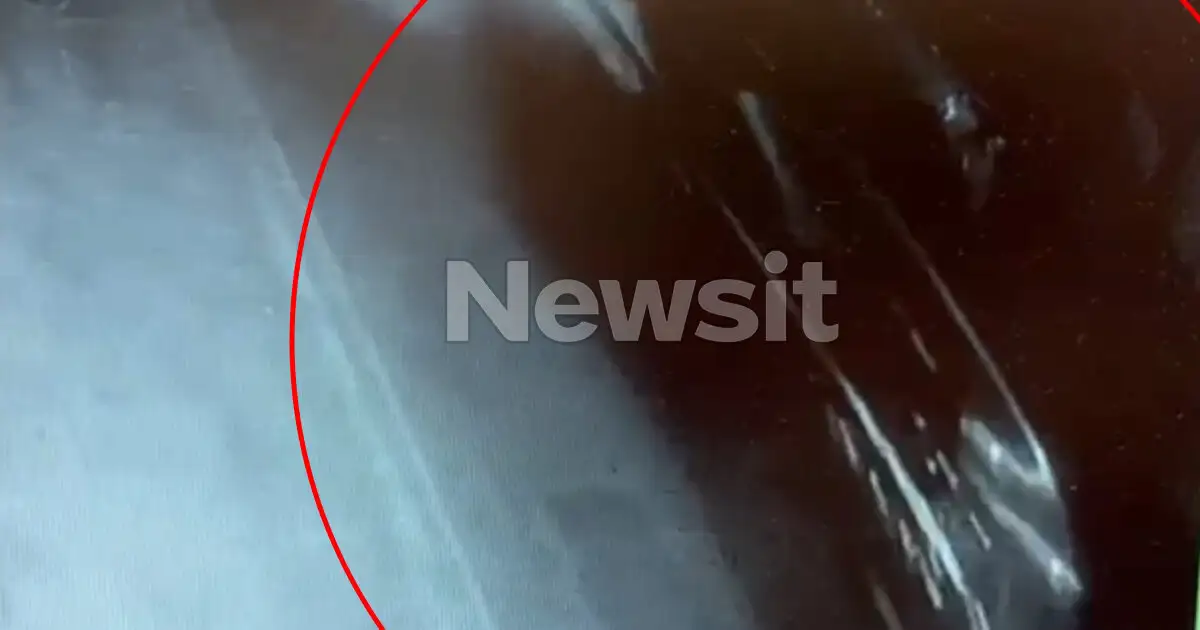Άργος:-Βίντεο-ντοκουμέντο-από-τη-στιγμή-της-καταδίωξης-του-20χρονου-–-Διασωληνωμένος-σε-κρίσιμη-κατάσταση-παραμένει-ο-νεαρός