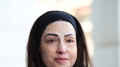 Ιωάννα-Παλιοσπύρου-για-τυχόν-αποφυλάκιση-της-γυναίκας-που-της-έριξε-βιτριόλι:-Μου-προκαλεί-σοκ,-είναι-εγκληματίας